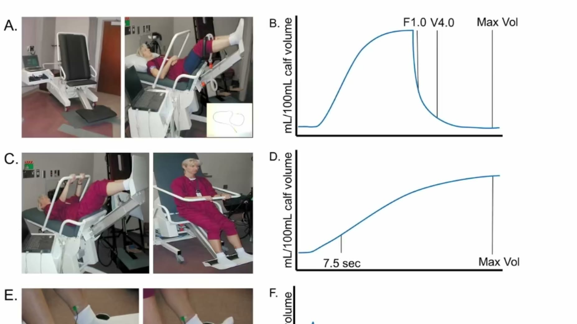 Halker and colleagues' 2020 study of 2,700 patients used venous plethysmography to measure blood motion effectiveness in