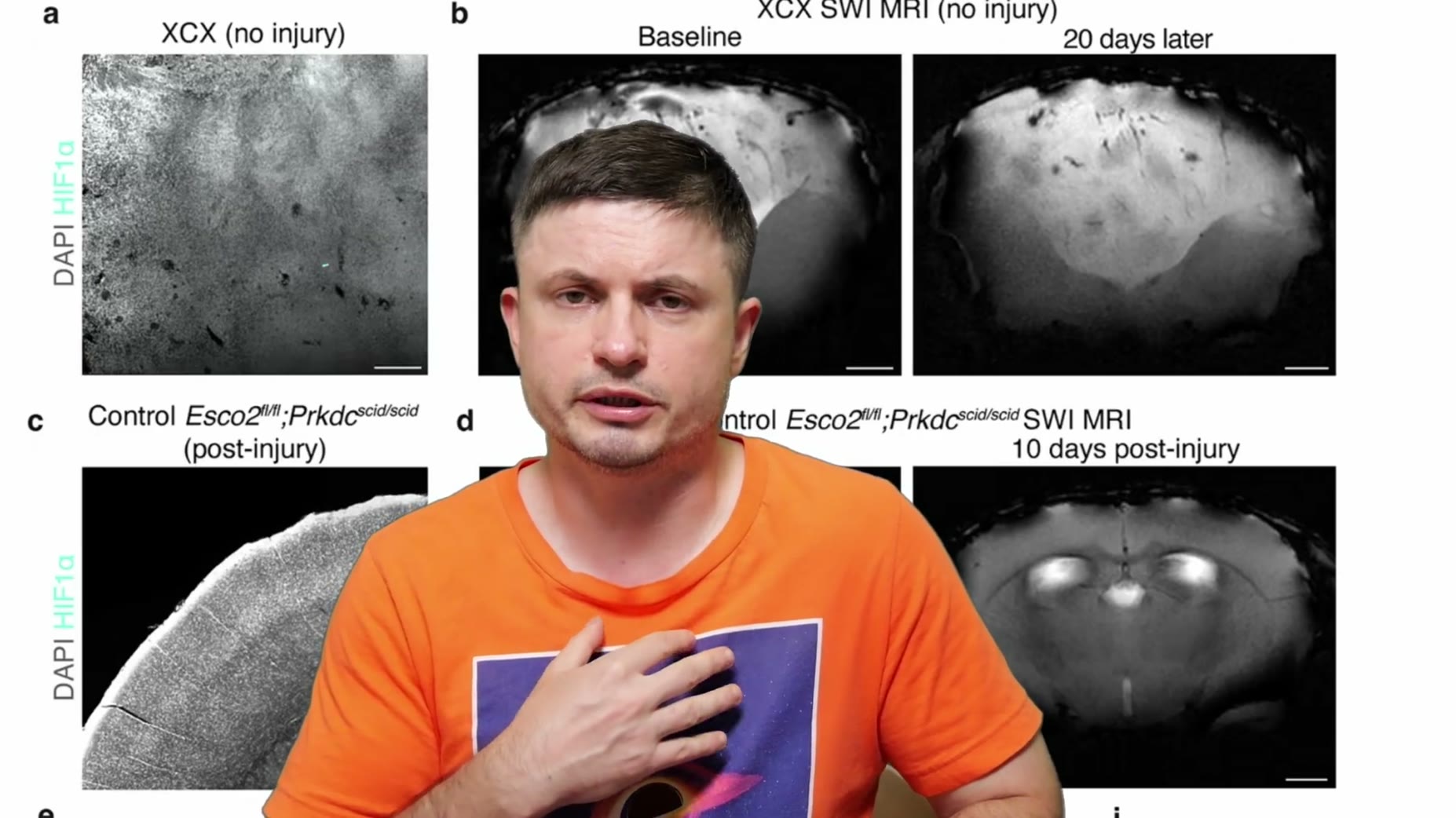 On-screen artifact [00:15:56]: A background figure panel displays labels referencing "Esco2/l;Prkdcscid/scid" mice with 